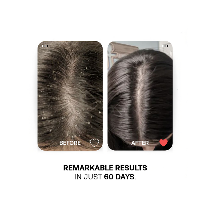Flake Free Duo