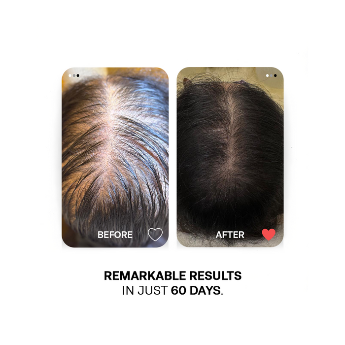 Hair Regrowth Combo